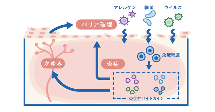 アトピー性皮膚炎のメカニズム