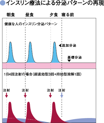 インスリン療法による分泌パターンの再現