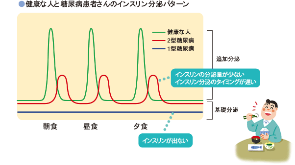 健康な人と糖尿病患者さんのインスリン分泌パターン