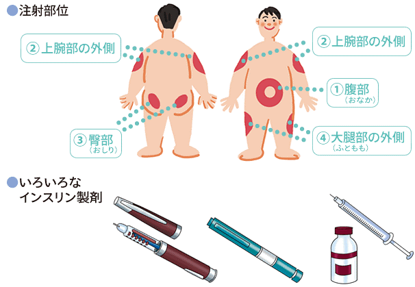 注射部位