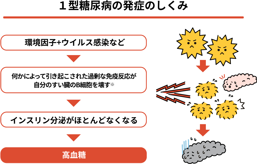 1型糖尿病の発症の仕組み